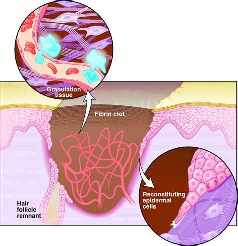 Fibrin:  Ein revolutionärer Werkstoff für die Geweberegeneration und Wundheilung!