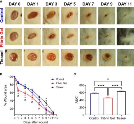  Fibrin:  Das Wundermaterial für Tissue Engineering und Wundheilung?