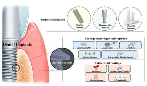  Implantatmaterialien: Ionenpolymerhydrogel für innovative Implantate!