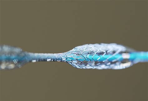 Nitinol: Hochwertige Biokompatibilität für Medizintechnik-Innovationen!